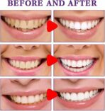 Crema blanqueadora de dientes pasta dental SP-157 - Imagen 2