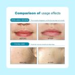 Crema depilatoria EELHOE FK23B-41 - Imagen 4