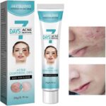Crema tratamiento acne mascarilla facial FK23B-39